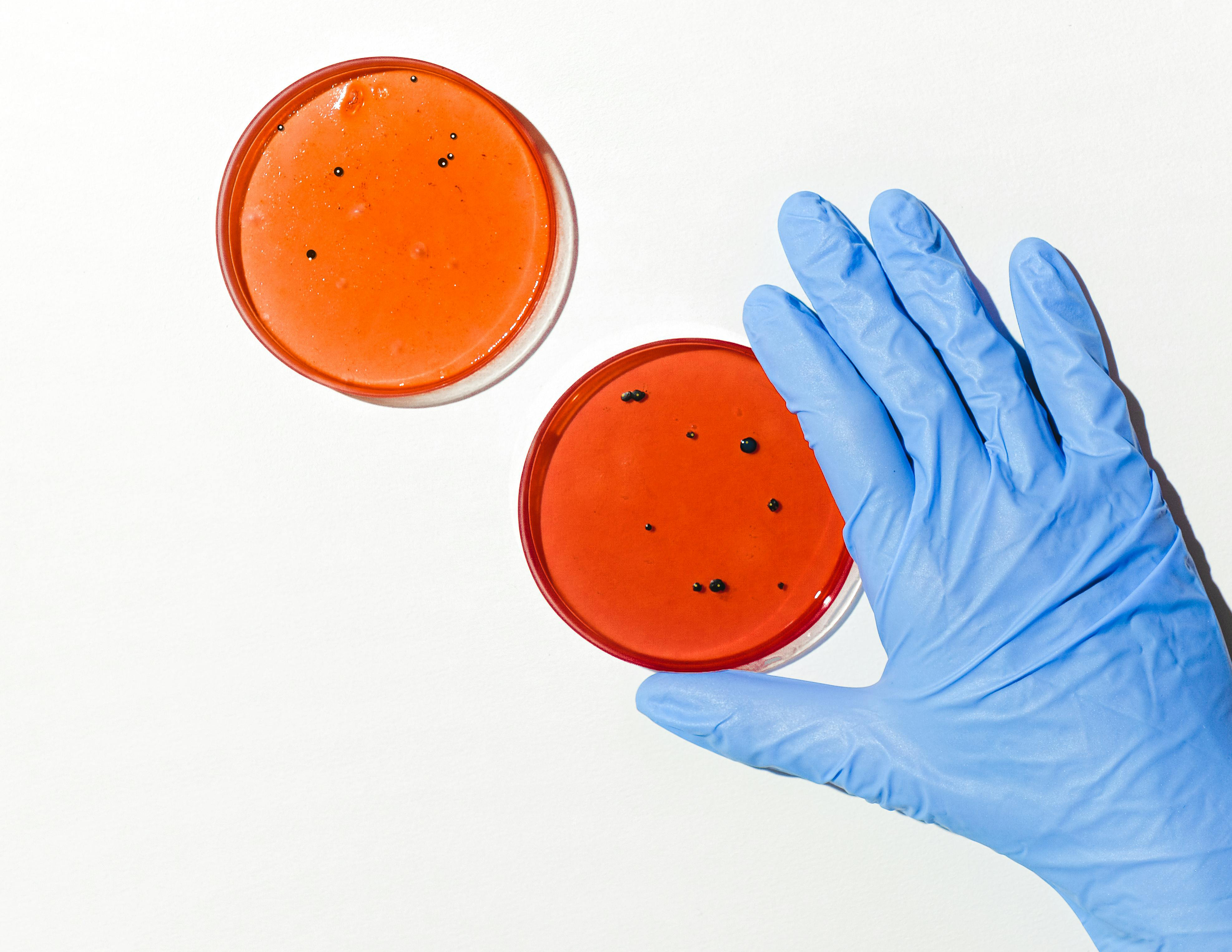 Cápsula | Desafiando la resistencia bacteriana: terapia con fagos
